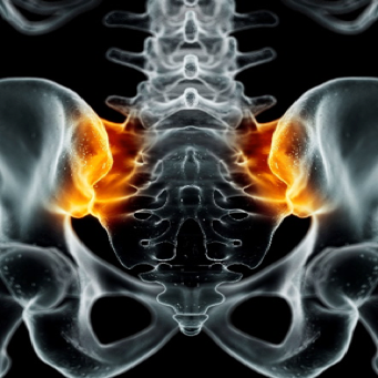 Non-radiographic axial spondyloarthritis