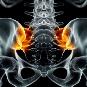 Non-radiographic axial spondyloarthritis Non-radiographic axial spondyloarthritis